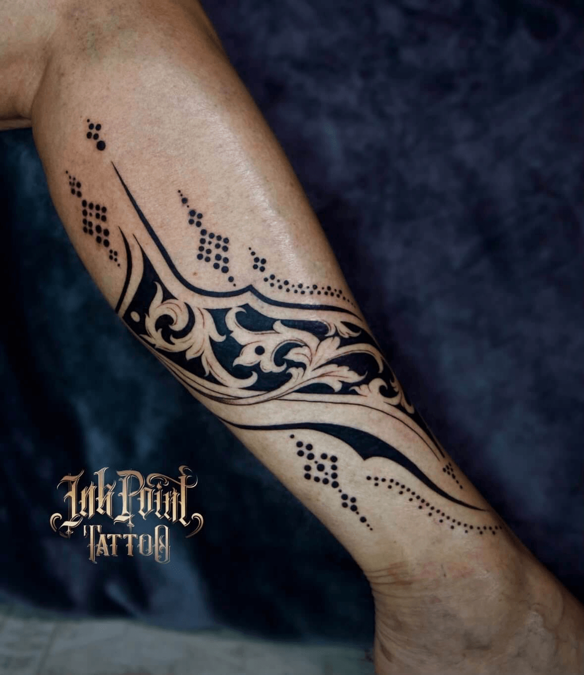 Arm